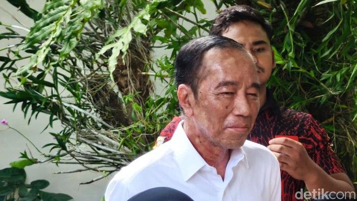 Mantan Presiden Jokowi Terserang Alergi Kulit Dibagian Wajah