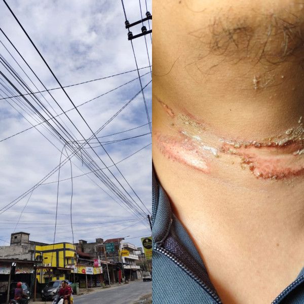 Terkait Kabel Optik Jerat Leher, DPMPTSP Panggil Provider Internet