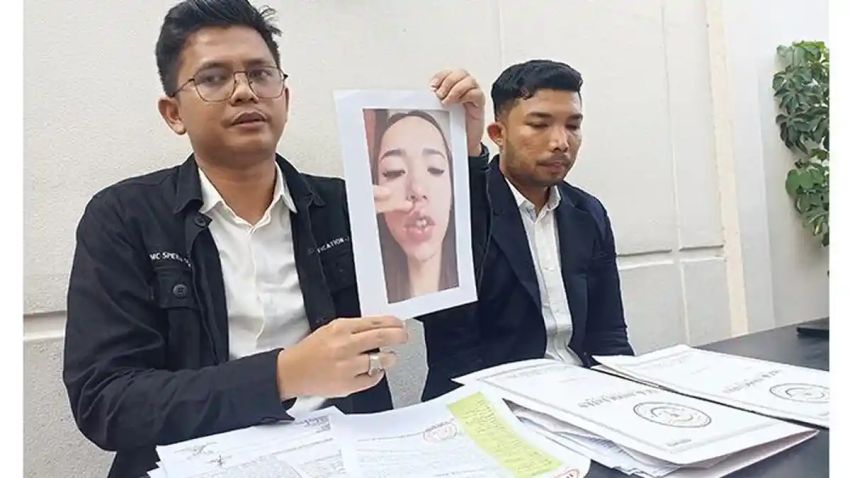 Ngaku-ngaku Dokter, Finalis Puteri Indonesia Riau jadi Tersangka