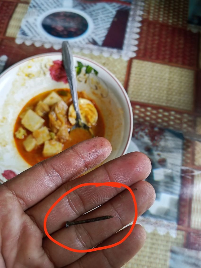 Makan Lontong Warga Dumai Temukan Paku Bangunan