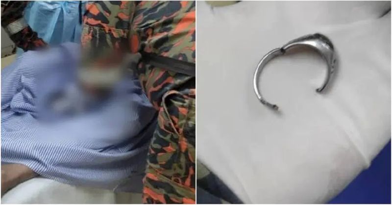 Damkar Dumai Berhasil Evakuasi Seorang Pria Kelaminnya Tersangkut Cincin